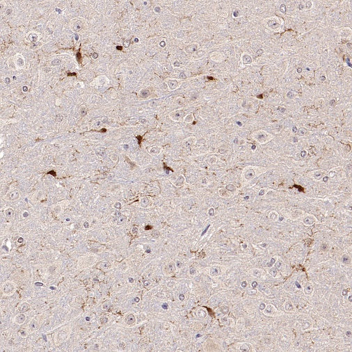 ASC/TMS1 Rabbit Polyclonal Antibody