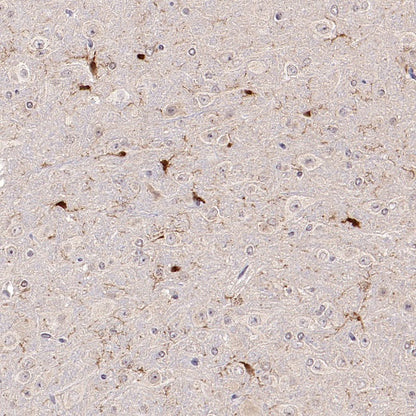 ASC/TMS1 Rabbit Polyclonal Antibody