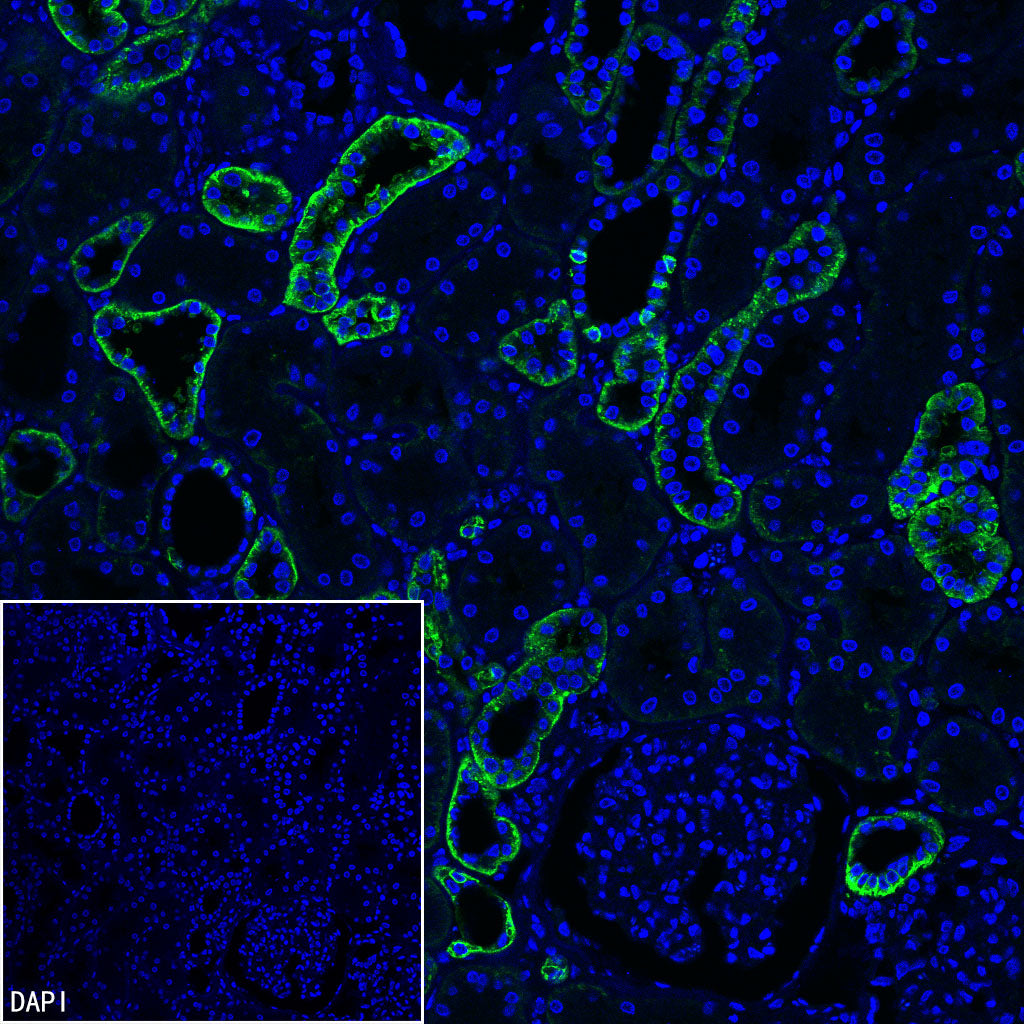 CA12 Rabbit Polyclonal Antibody