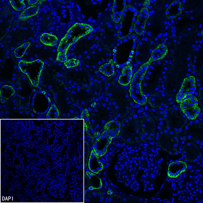 CA12 Rabbit Polyclonal Antibody