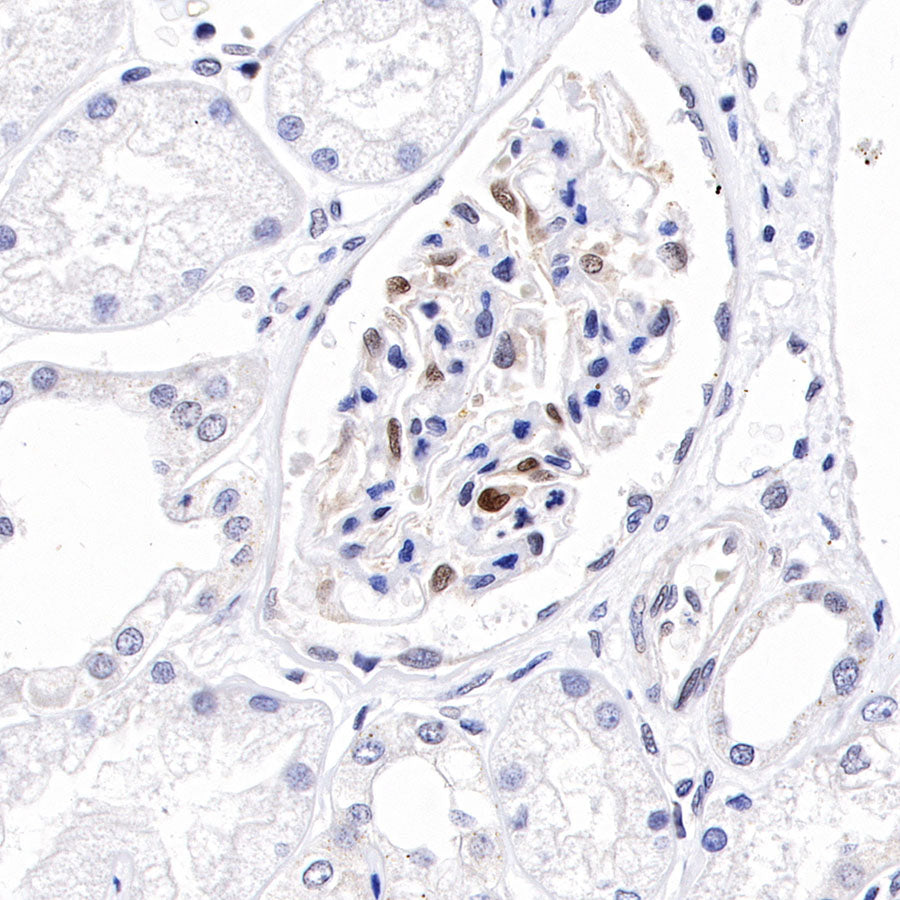 Cyclin D3 Recombinant Rabbit mAb (SDT-R124)