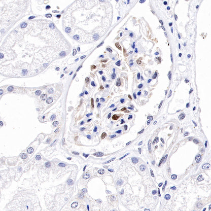 Cyclin D3 Recombinant Rabbit mAb (SDT-R124)