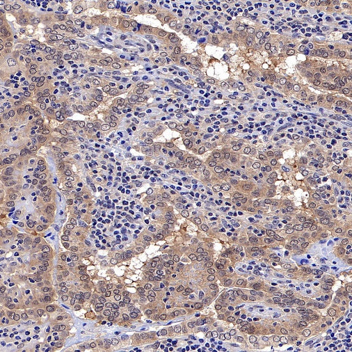 Akt (pan) Recombinant Rabbit mAb (S-652-20)