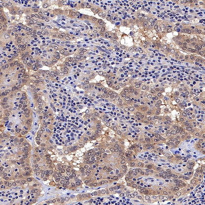 Akt (pan) Recombinant Rabbit mAb (S-652-20)