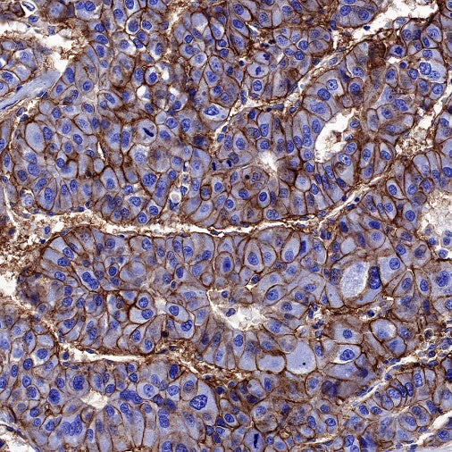 NaK-ATPase Recombinant Rabbit mAb (S-1373-39)