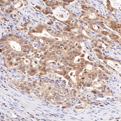 S100A11 Recombinant Rabbit mAb (S-821-4)