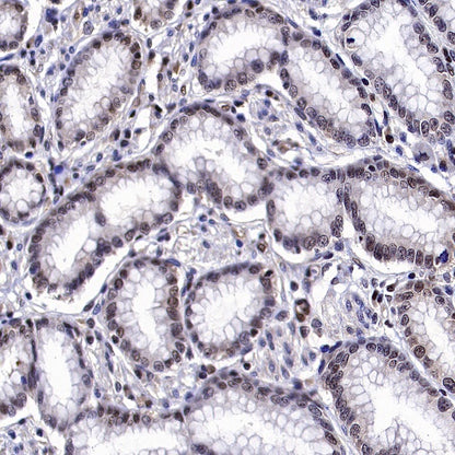 MGMT Recombinant Rabbit mAb (SDT-522-71)