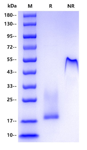 Human CGA&LHB Protein, No tag&His tag