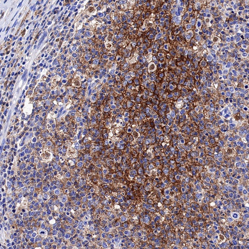 Syntenin Recombinant Rabbit mAb (S-1692-5)