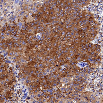 M6PR Recombinant Rabbit mAb (S-1480-21)