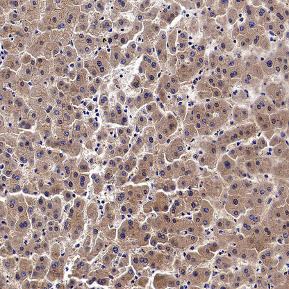 WSB1 Recombinant Rabbit mAb (S-3505-23)