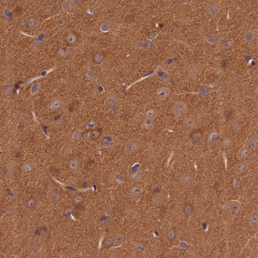 p38 MAPK Recombinant Rabbit mAb (S-508-19)