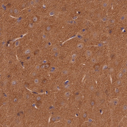 p38 MAPK Recombinant Rabbit mAb (S-508-19)