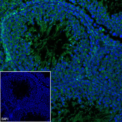 Mitofilin Recombinant Rabbit mAb (S-2277-37)