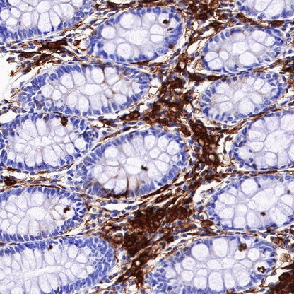 HLA-DP alpha1 Recombinant Rabbit mAb (S-R243)