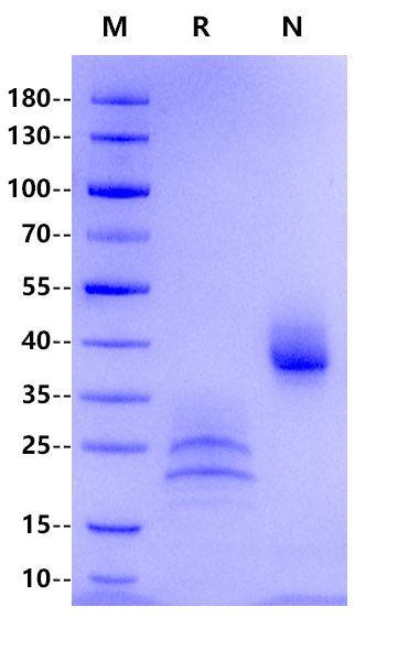 CD3 epsilon His Tag Protein, Human