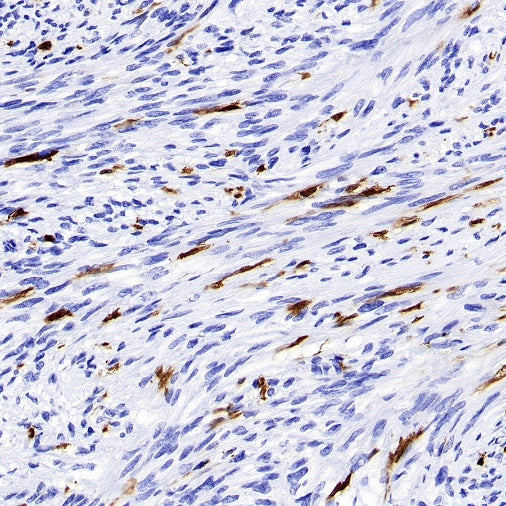 S-RMab® Factor XIIIa Recombinant Rabbit mAb (SDT-R278)