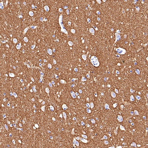 SNAP25 Recombinant Rabbit mAb (S-1828-67)