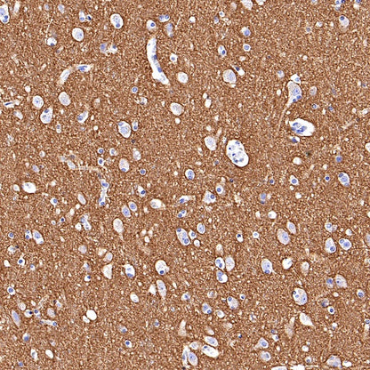 SNAP25 Recombinant Rabbit mAb (S-1828-67)