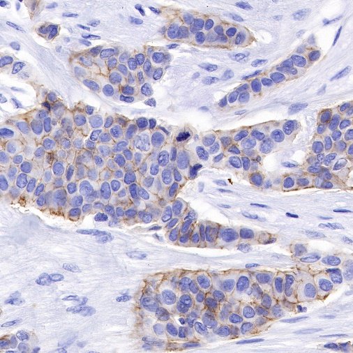 Nectin-4 Recombinant Rabbit mAb (SDT-277-314-1)
