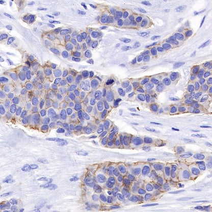 Nectin-4 Recombinant Rabbit mAb (SDT-277-314-1)
