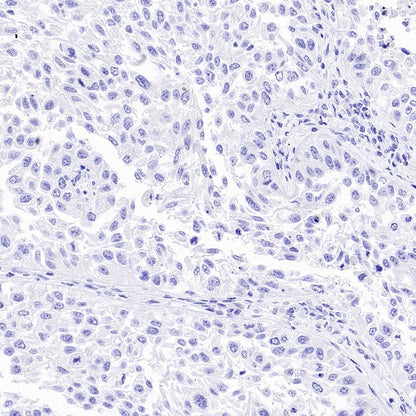 INSM1 Recombinant Rabbit mAb,PBS Only (SDT-3165-72)