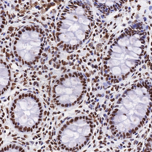 TDP43 Recombinant Rabbit mAb (S-R354)