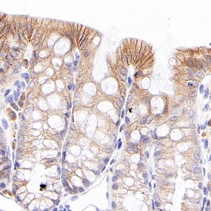 S-RMab® ErbB3 Recombinant Rabbit mAb (SDT-991-10)