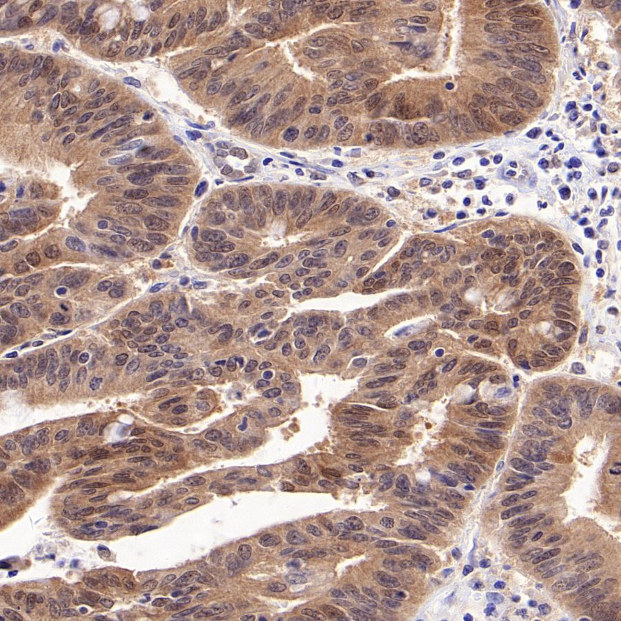4E-BP1 Recombinant Rabbit mAb (S-1654-47)