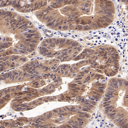 4E-BP1 Recombinant Rabbit mAb (S-1654-47)