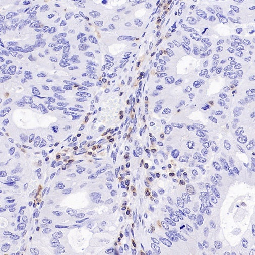 NFAT2 Recombinant Mouse mAb (S-4705)