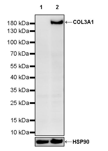 COL3A1 Recombinant Rabbit mAb (S-4338)