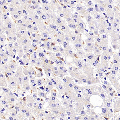 AXL Recombinant Rabbit mAb (S-2199-80)