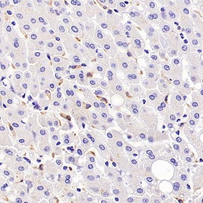 AXL Recombinant Rabbit mAb (S-2199-80)