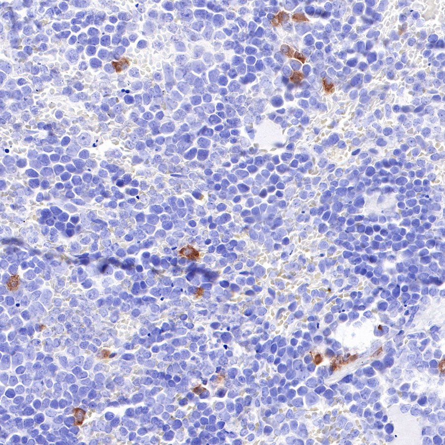 CD30 Recombinant Rabbit mAb (SDT-216-2)