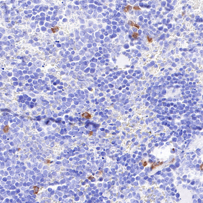 CD30 Recombinant Rabbit mAb (SDT-216-2)