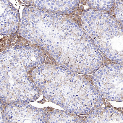 KL Recombinant Rabbit mAb (S-2245-169)