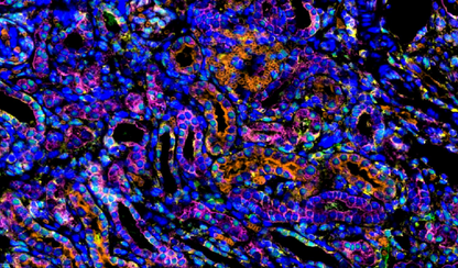 Absin 5-Color IHC Kit (Anti-Rabbit Secondary Antibody)