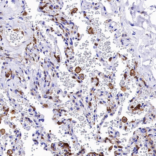 S-RMab® MCT4 Recombinant Rabbit mAb (S-1437-7)