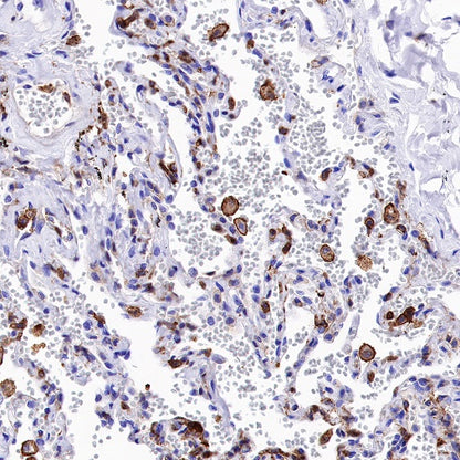 S-RMab® MCT4 Recombinant Rabbit mAb (S-1437-7)