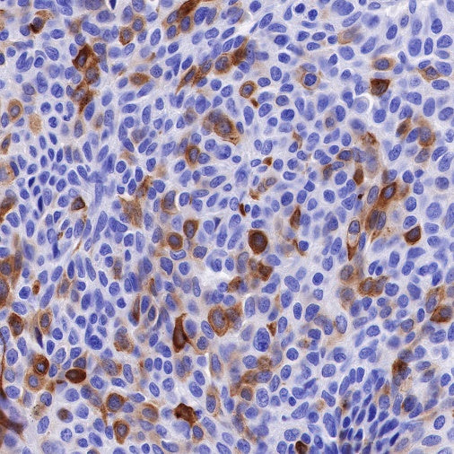 TFF1 Recombinant Rabbit mAb (S-481-16)