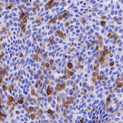 TFF1 Recombinant Rabbit mAb (S-481-16)