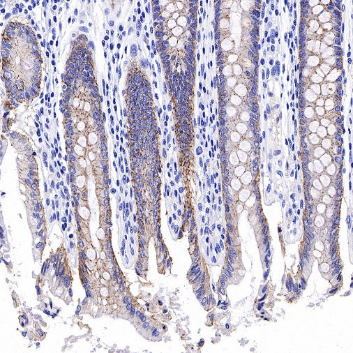 Claudin 3 Recombinant Rabbit mAb (S-819-131)
