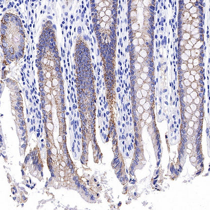 Claudin 3 Recombinant Rabbit mAb (S-819-131)