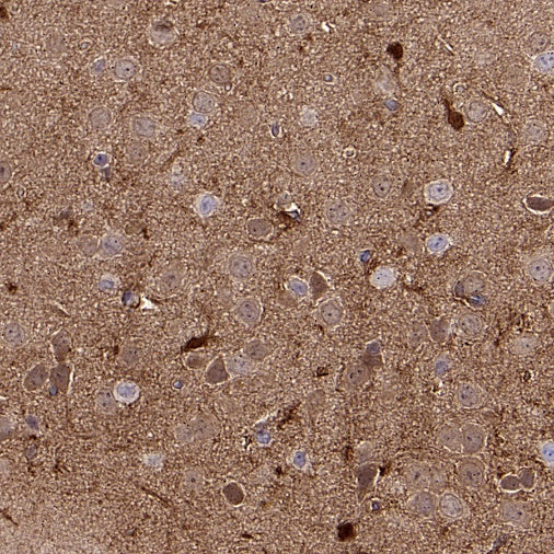 AKT2 Recombinant Rabbit mAb (S-2617-6)