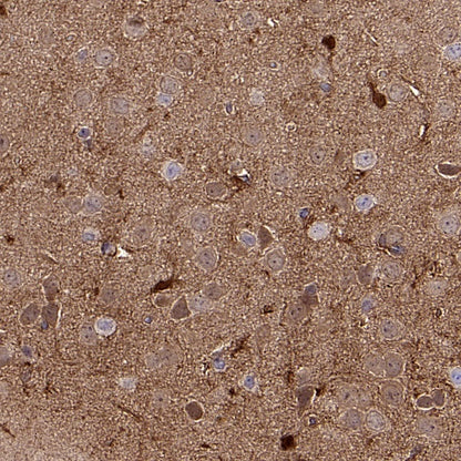 AKT2 Recombinant Rabbit mAb (S-2617-6)