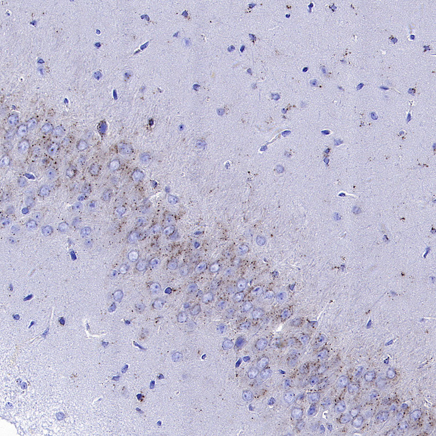 Galactosylceramidase Recombinant Rabbit mAb (S-3402-17)