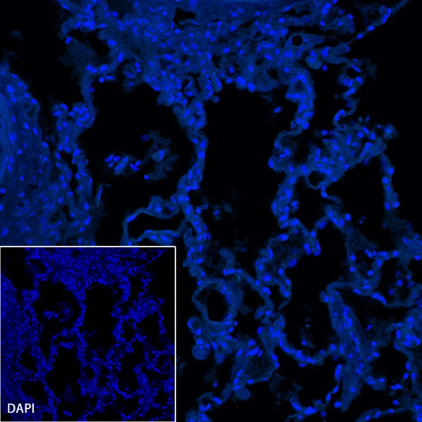 S-RMab® CD23 Recombinant Rabbit mAb (SDT-028-67)