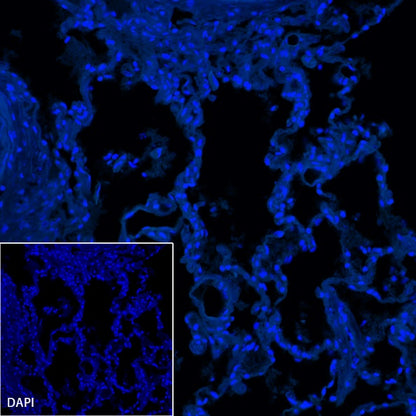 S-RMab® CD23 Recombinant Rabbit mAb (SDT-028-67)