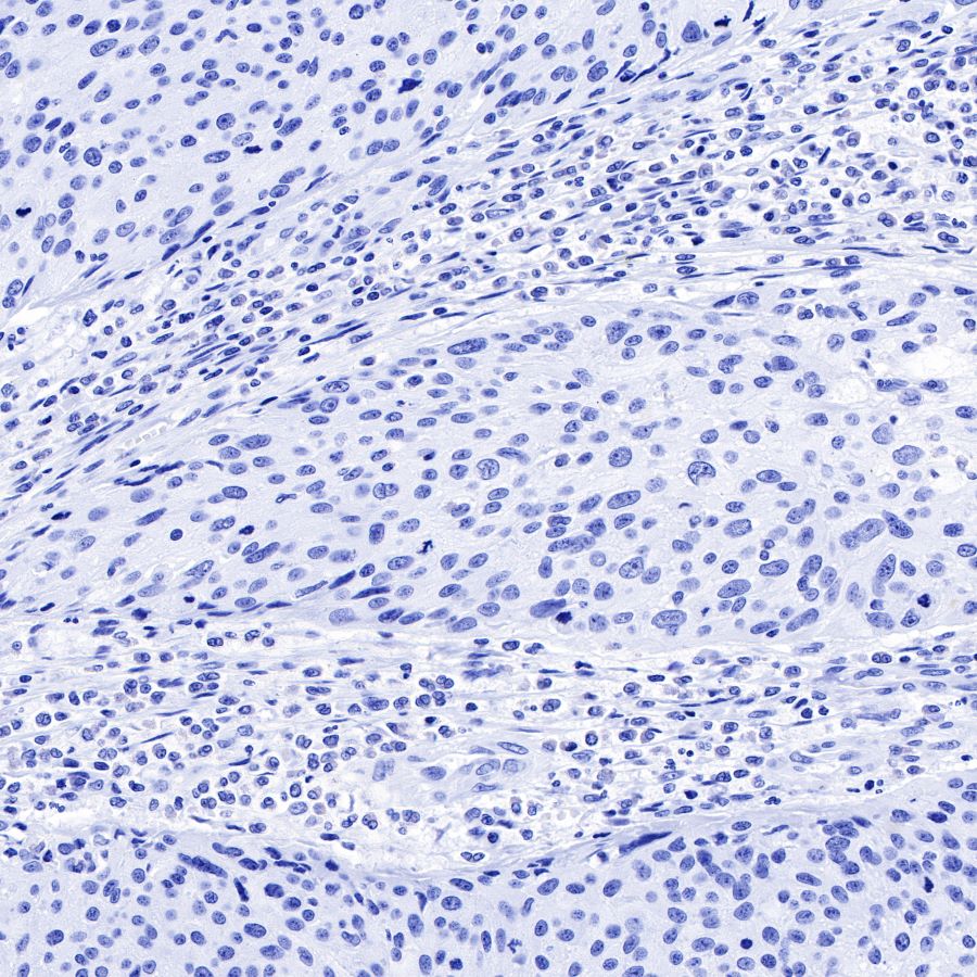alpha-actinin-2 Recombinant Rabbit mAb (SDT-032-79)